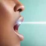 BLANCHIMENT DES DENTS AU LASER